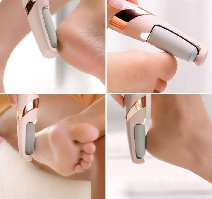 Rechargeable Electric Foot File Callus Remover